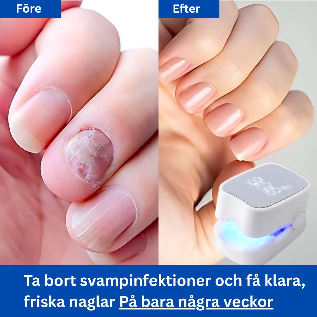KlarNagel Pro 2.0