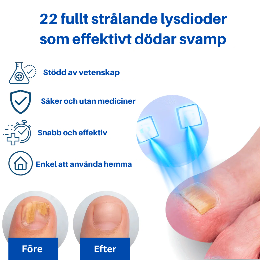OnyClear™- Laser mot nagelsvamp