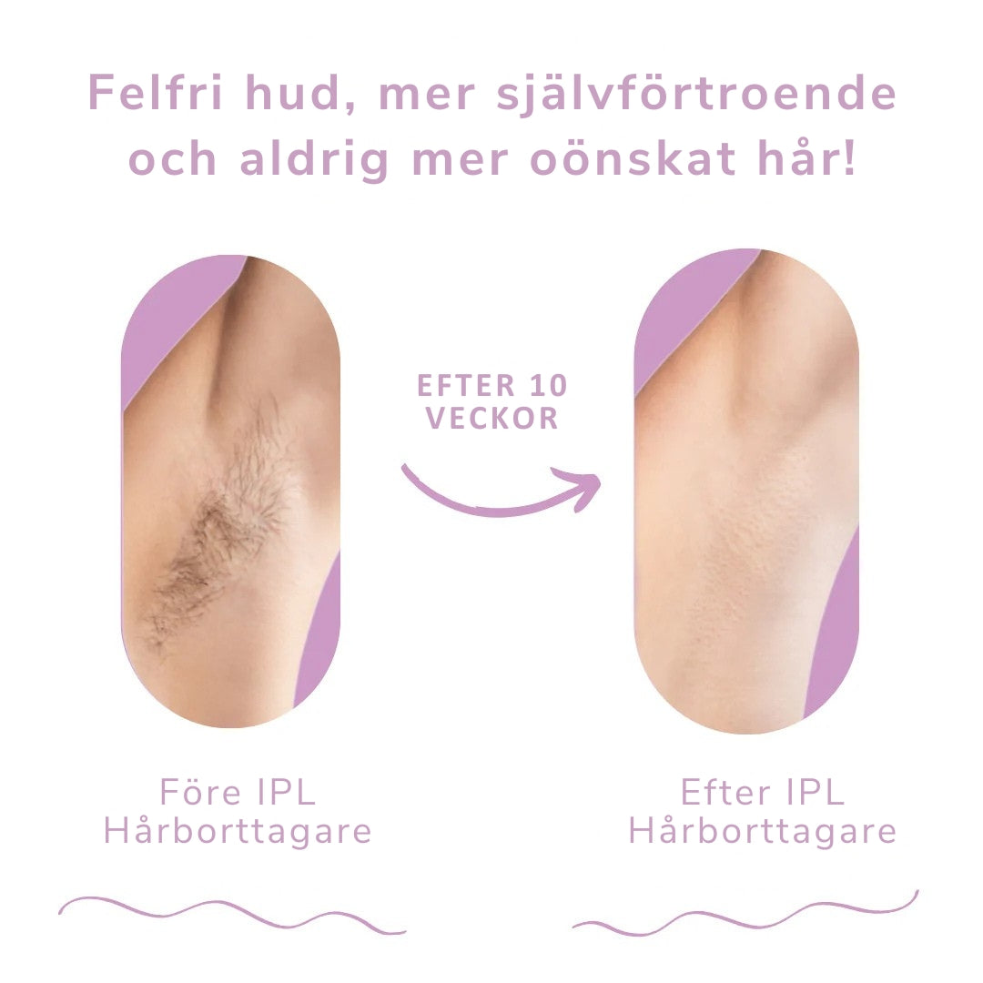 Nova IPL-handset