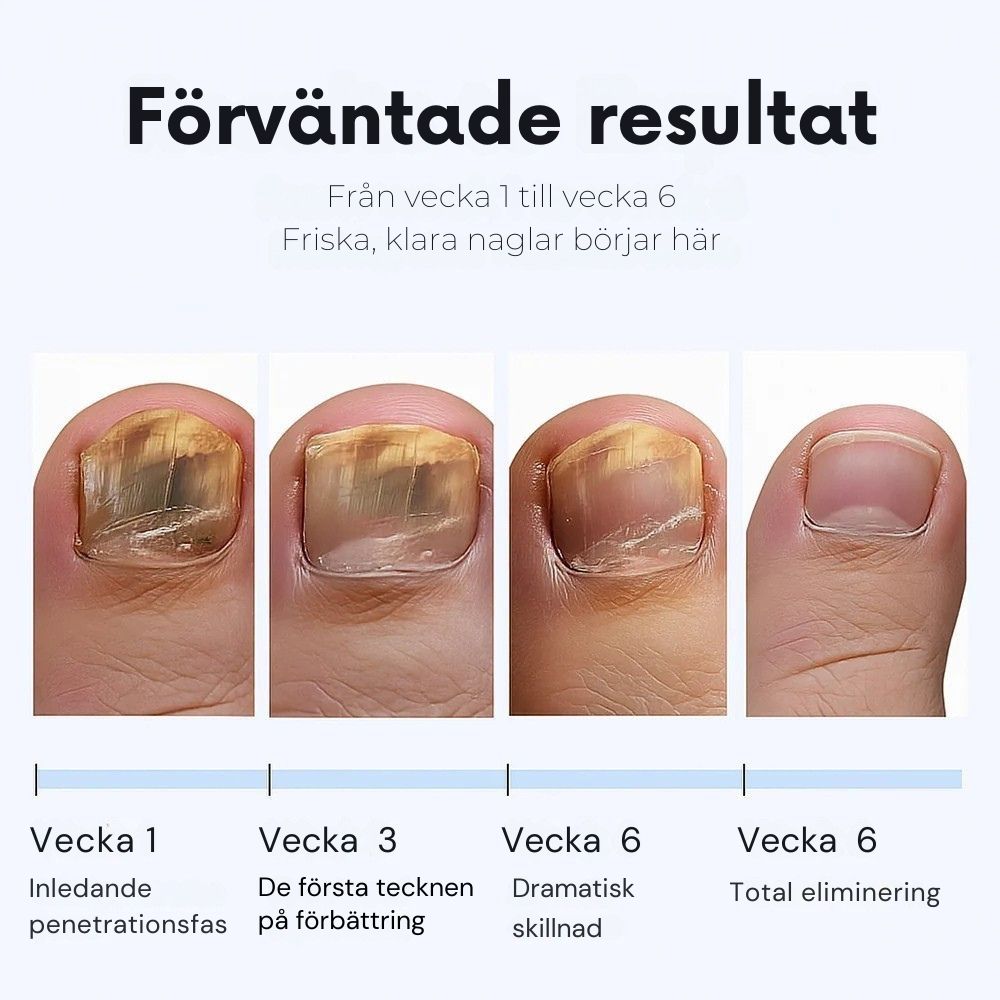 ClearNail – Nagelförnyande plåster mot svamp bundle
