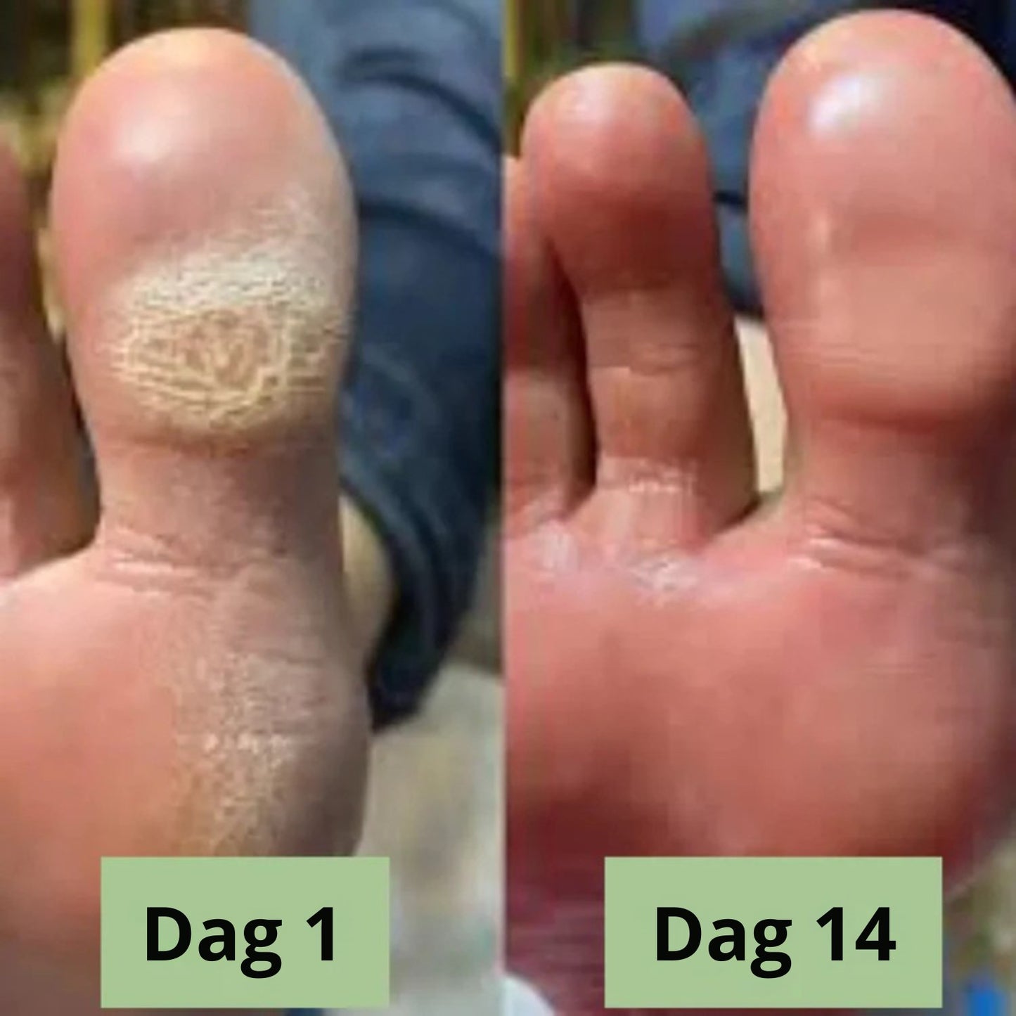 Nova svampdödande tvål