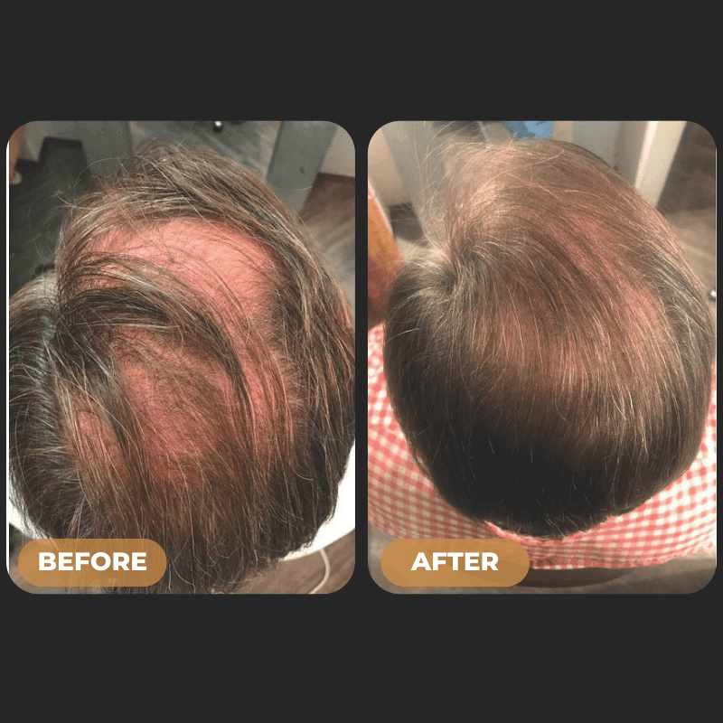 SPARTAN™ - Root Activator Shampoo