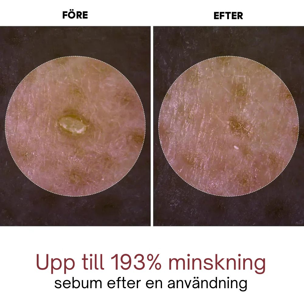 Rice Peel Glow Serum Ampoule