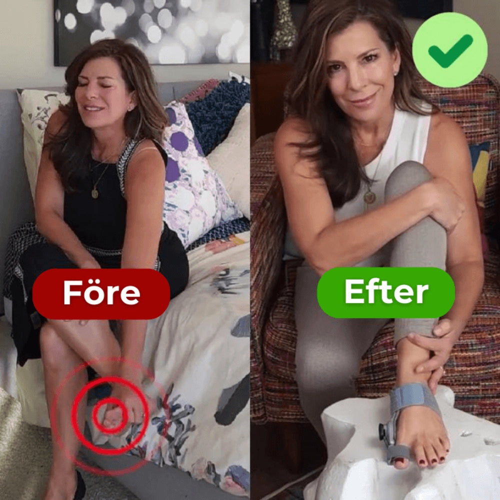 Mjuk Justering Och Smärtlindring För Hallux Valgus