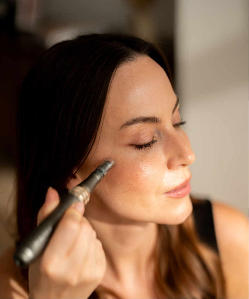 Microneedling Hemma – Guide