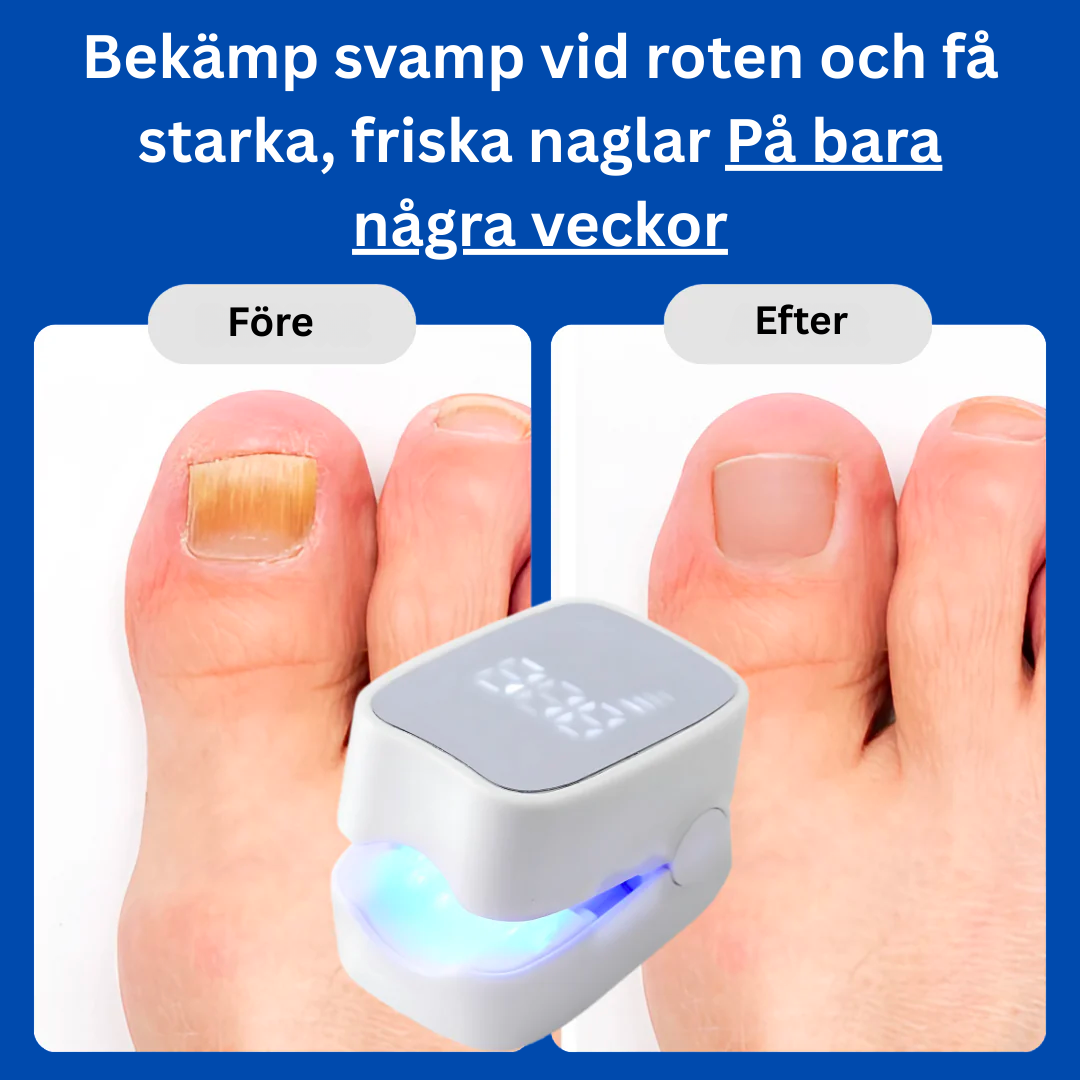 KlarNagel Pro 2.0