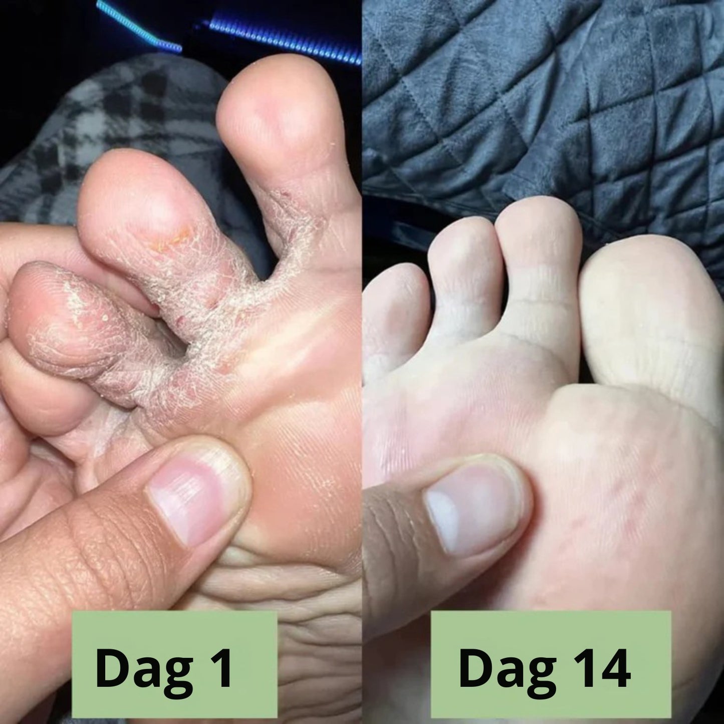 Nova svampdödande tvål