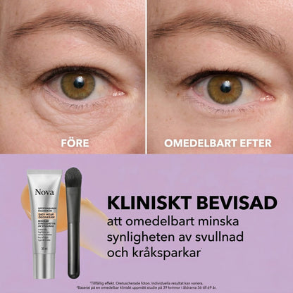 Nova™ - Huduppstramande kräm