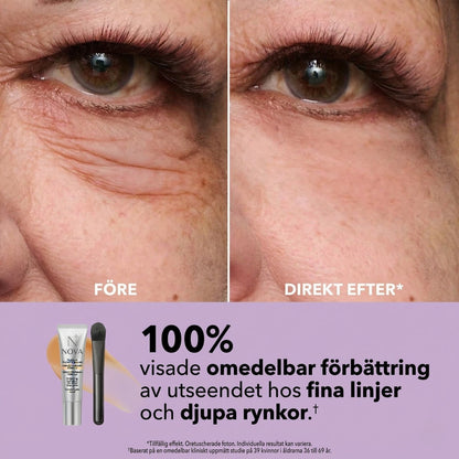 Nova™ - Huduppstramande kräm