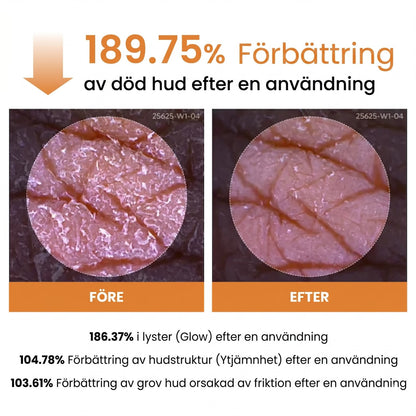 Peel Shot exfolierande spray med kojinsyra och gurkmeja