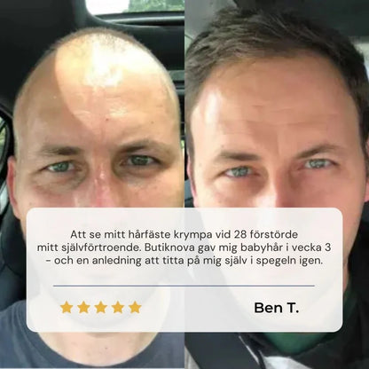 Butiknova Hårrot Återställande Serum