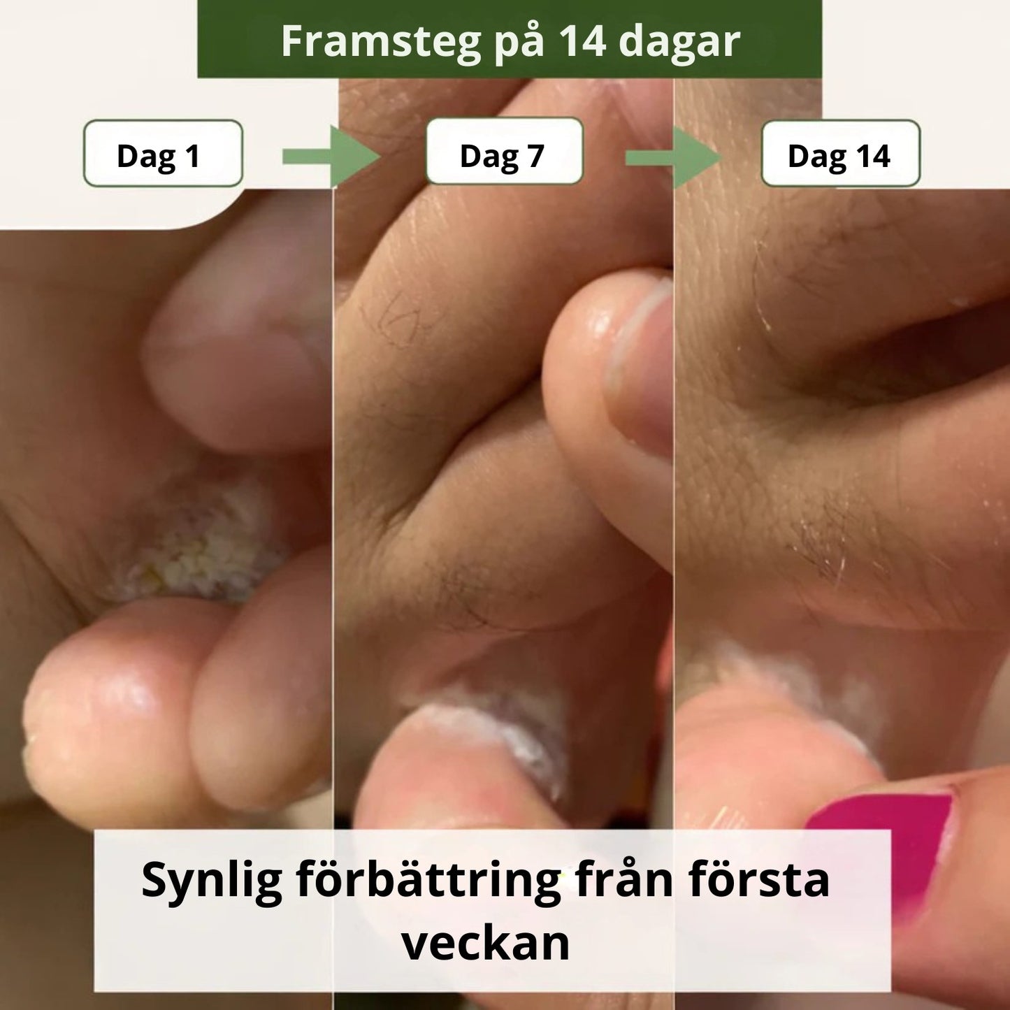 Nova svampdödande tvål