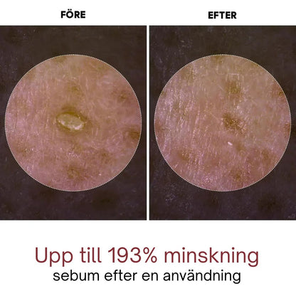 Rice Peel Glow Serum Ampoule