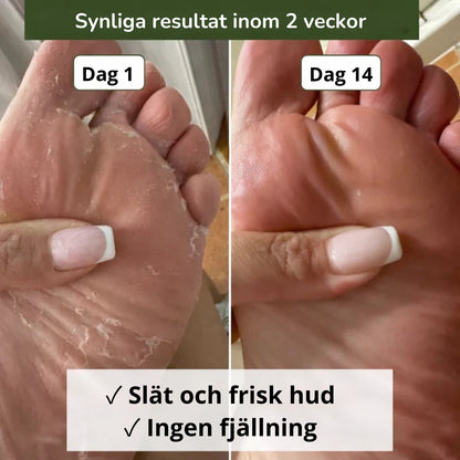 Nova svampdödande tvål