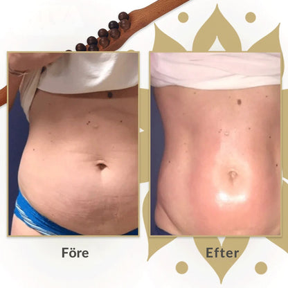 Nova Gua Sha trä-terapistav