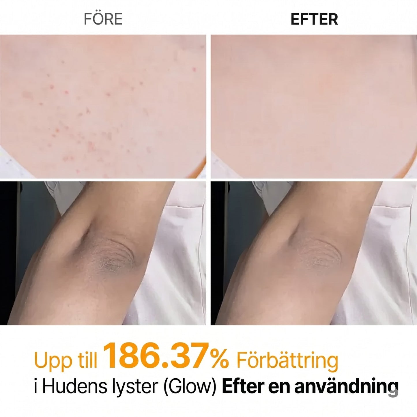 Peel Shot exfolierande spray med kojinsyra och gurkmeja