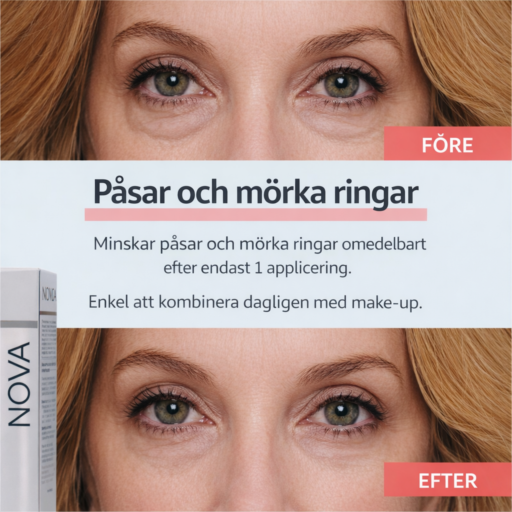 NOVA Påsar Mörka Ringar – bild 2