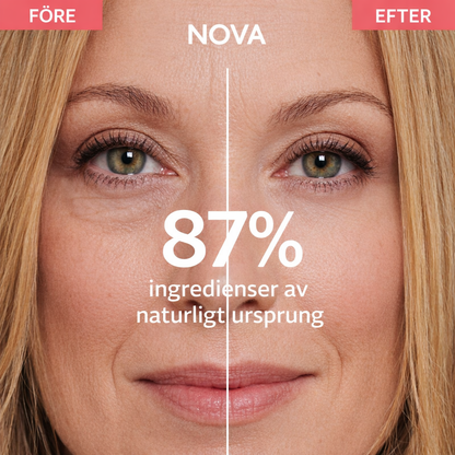 NOVA Påsar Mörka Ringar – bild 4