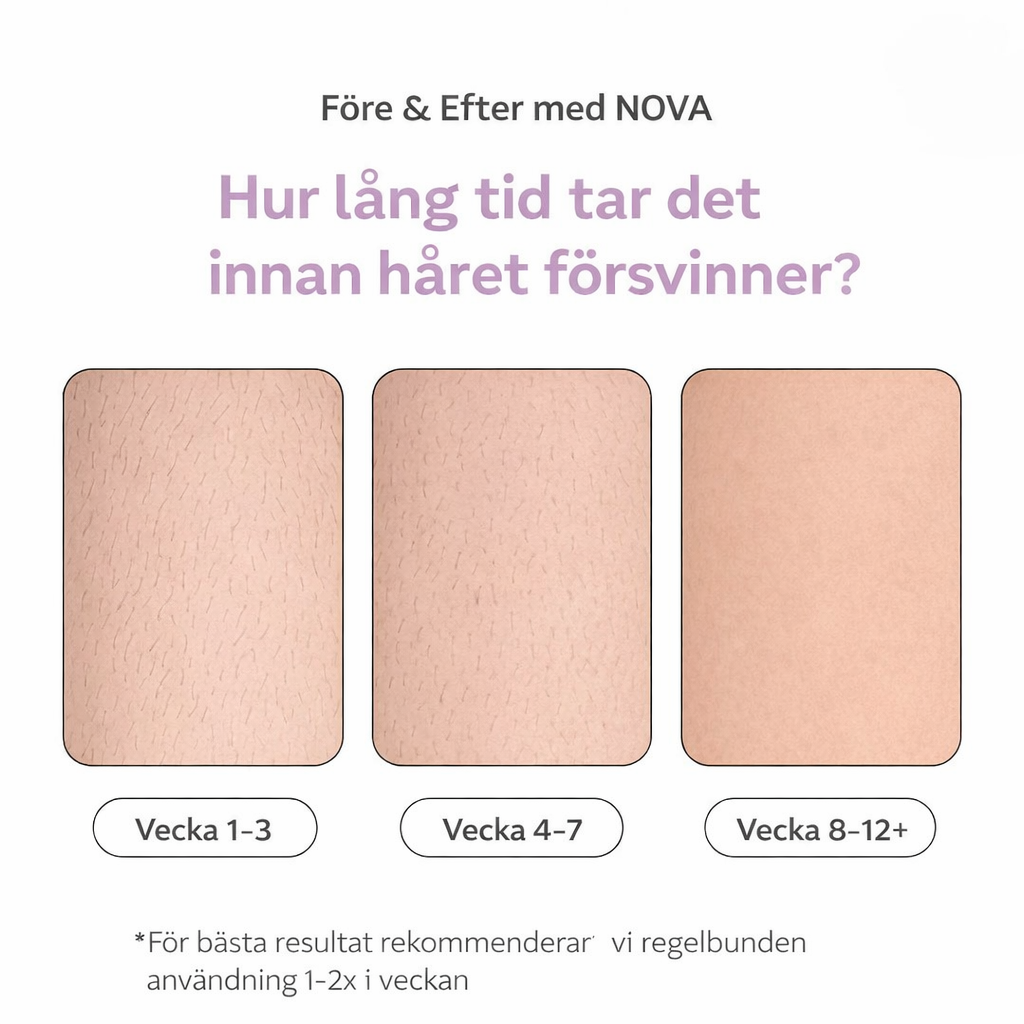 NOVA IPL