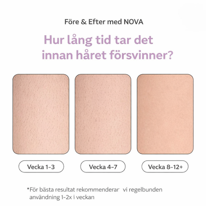 NOVA IPL