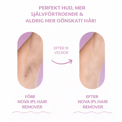 NOVA™ IPL Hårborttagning — Permanent silkeslen hud hemma