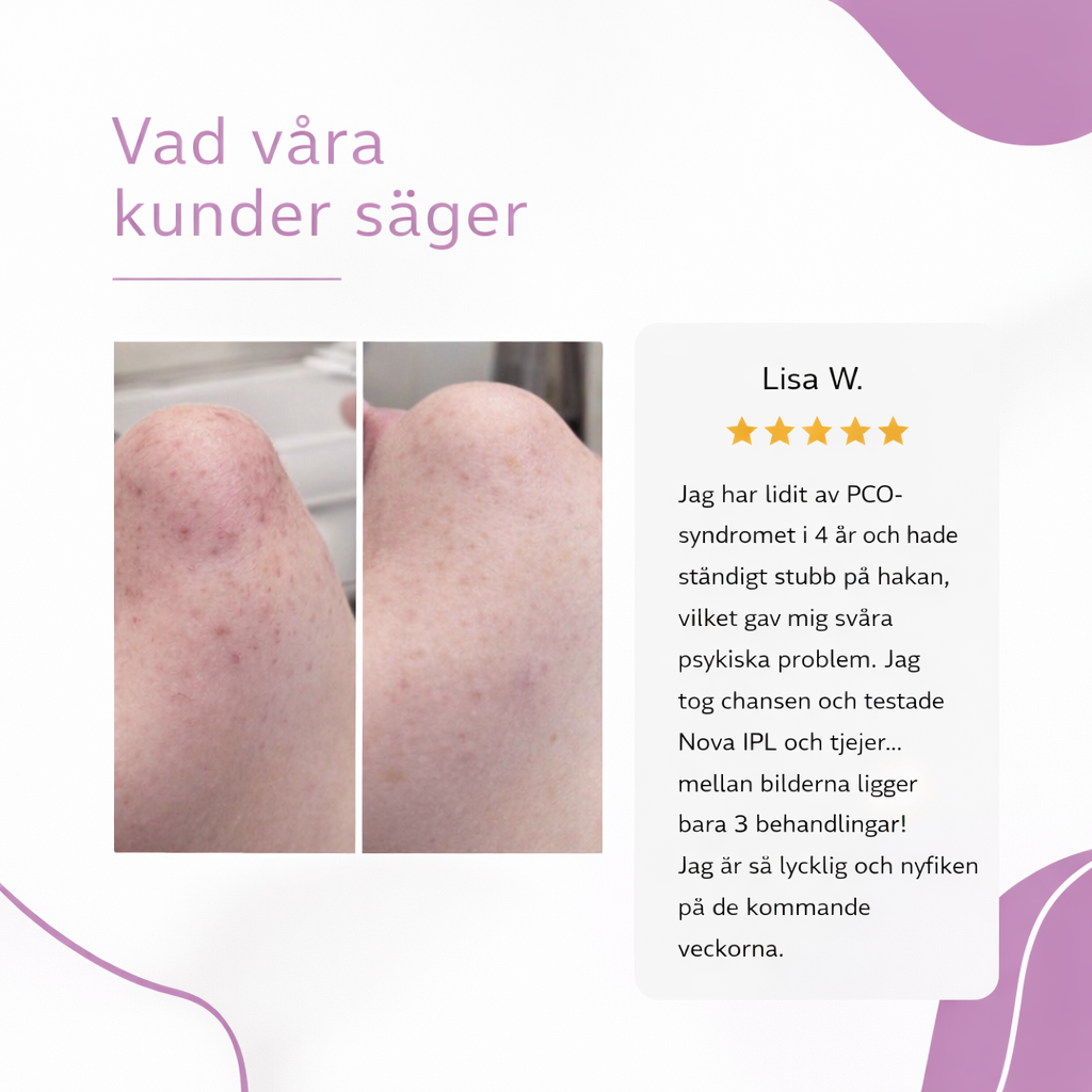 NOVA™ IPL Hårborttagning — Permanent silkeslen hud hemma