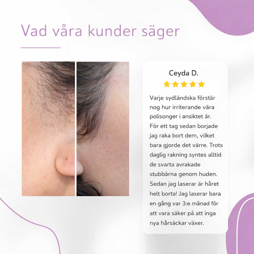 NOVA™ IPL Hårborttagning — Permanent silkeslen hud hemma