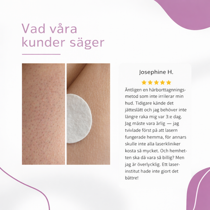 NOVA™ IPL Hårborttagning — Permanent silkeslen hud hemma